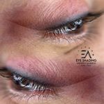 مرکز فیبروز سعیده غارسی