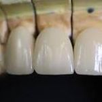 دندانسازی آرش منبری