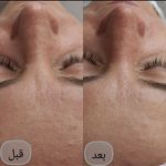 کلینیک تخصصی پوست ملینا