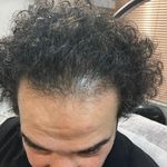 کلینیک تخصصی پوست،مو،زیبایی،لیزر لاولی