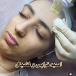 کلینیک تخصصی پوست،مو،زیبایی،لیزر لاولی