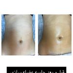 کلینیک تخصصی پوست،مو،زیبایی،لیزر لاولی
