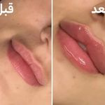 کلینیک تخصصی پوست،مو،زیبایی،لیزر لاولی