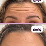 کلینیک زیبایی و لاغری و لیزر لوتوس