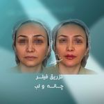 مطب پوست زيبايی ليزر دکتر شاه نعمت الهی