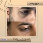 مطب پوست مو زیبایی فردوس شرق
