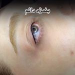 میکرو مهدیه