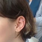 کلینیک هانیل | فیلر و بوتاکس شرق