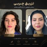 کلینیک تخصصی زیبایی و لیزر موی ابریشم