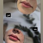 کلینیک زیبایی لاغری لیزر دانا