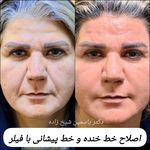کلینیک پوست مو زیبایی و لیزر کیمیا