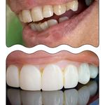 دندانپزشکی دکتر آزاده خلجیان