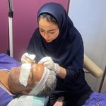 بهترين كاشت ابرو و مو مشهد خانم معين