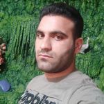 بهترین دکتر کاشت مو در بندرعباس، فاطمه سینایی