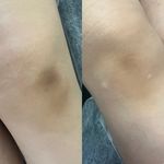 کلینیک پوست مو لیزر و لاغری عصر زیبایی