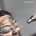 لیزر،پوست،مو(منطقه ۷ تهران)دکتر محمودی