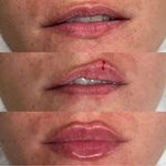 لیزر،پوست،مو(منطقه ۷ تهران)دکتر محمودی