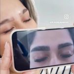 لیزر،پوست،مو(منطقه ۷ تهران)دکتر محمودی