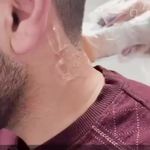 لیزر،پوست،مو(منطقه ۷ تهران)دکتر محمودی