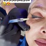 لیزر،پوست،مو(منطقه ۷ تهران)دکتر محمودی