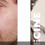 لیزر،پوست،مو(منطقه ۷ تهران)دکتر محمودی