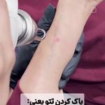 لیزر،پوست،مو(منطقه ۷ تهران)دکتر محمودی