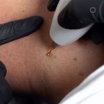 لیزر،پوست،مو(منطقه ۷ تهران)دکتر محمودی