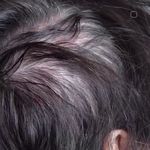 لیزر،پوست،مو(منطقه ۷ تهران)دکتر محمودی