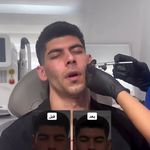 لیزر،پوست،مو(منطقه ۷ تهران)دکتر محمودی