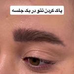 لیزر،پوست،مو(منطقه ۷ تهران)دکتر محمودی