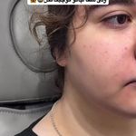 لیزر،پوست،مو(منطقه ۷ تهران)دکتر محمودی