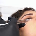 لیزر،پوست،مو(منطقه ۷ تهران)دکتر محمودی