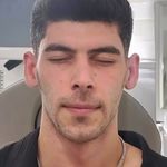 لیزر،پوست،مو(منطقه ۷ تهران)دکتر محمودی