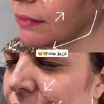 لیزر،پوست،مو(منطقه ۷ تهران)دکتر محمودی