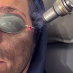 لیزر،پوست،مو(منطقه ۷ تهران)دکتر محمودی