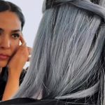 لیزر،پوست،مو(منطقه ۷ تهران)دکتر محمودی