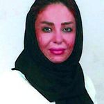 مرکزپیشرفته زیبایی ولاغری(لایلک)