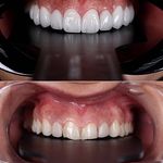 دندانپزشکی دکتر هومن باقری (بیمه نداریم)