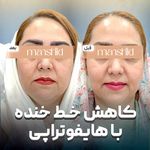 کلینیک زیبایی مانشید
