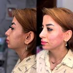 کلینیک تخصصی لیزر موهای زائد پریناز شرق