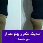 طب سنتی عامری (حجامت و بادکش)