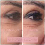 کلینیک زیبایی و لیزر مایا (دکتر وحیدی)