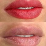 مرکز فیبروز و آرایش دائم عاطفه