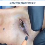 مرکز فیبروز و آرایش دائم عاطفه