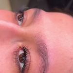 مرکز فیبروز و آرایش دائم عاطفه