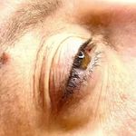 مرکز فیبروز و آرایش دائم عاطفه