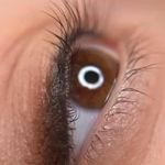 مرکز فیبروز و آرایش دائم عاطفه