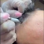 مرکز فیبروز و آرایش دائم عاطفه