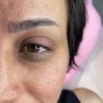 مرکز فیبروز و آرایش دائم عاطفه