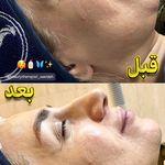 فیشال تخصصی  سعیده صدیقی